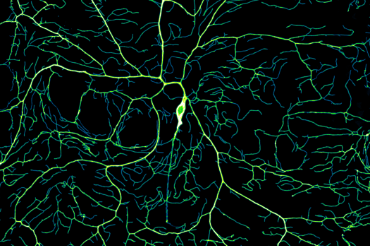 Developing Dendrites: The complex and highly variable dendritic morphologies emerge from the stochastic dynamics of dendrite tips. This maximum intensity projected image is pseudo colored based on the intensity value.