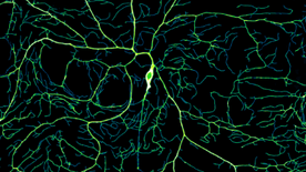Developing Dendrites: The complex and highly variable dendritic morphologies emerge from the stochastic dynamics of dendrite tips. This maximum intensity projected image is pseudo colored based on the intensity value.